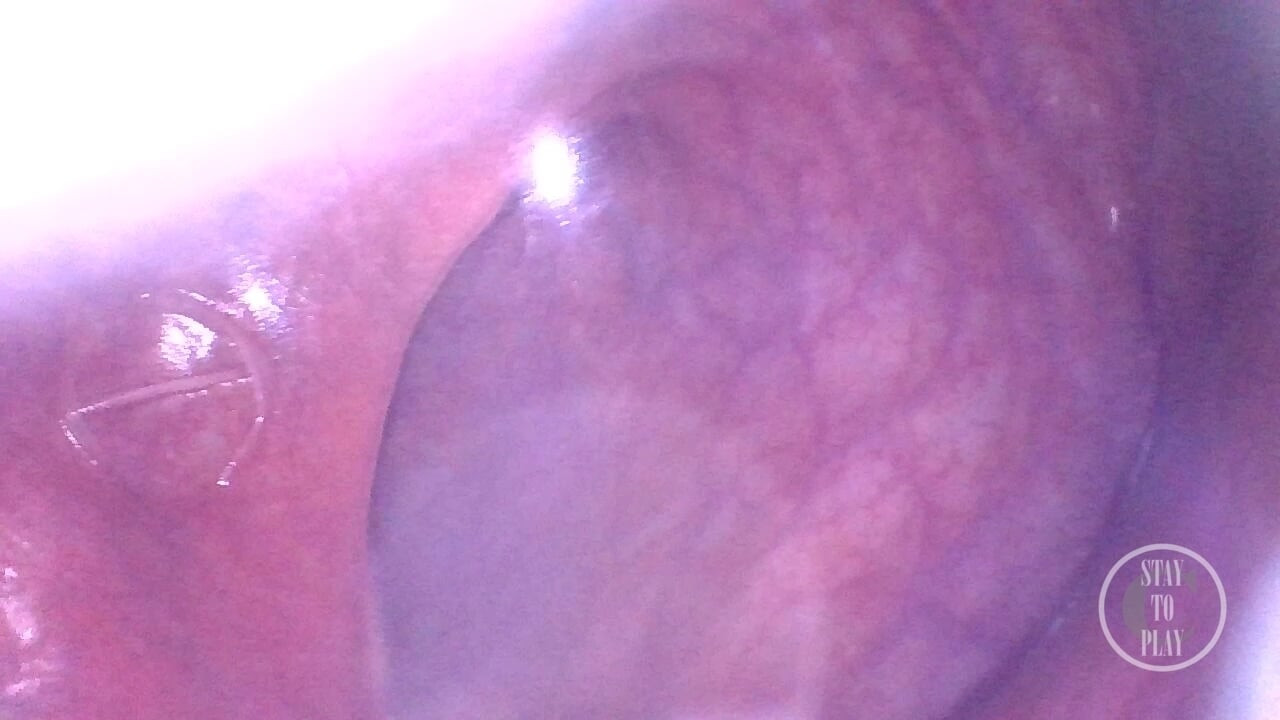 Look deep inside my ass!