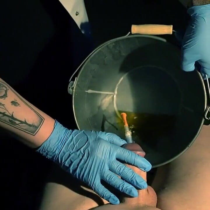 視点患者。カテーテルの進行と挿入