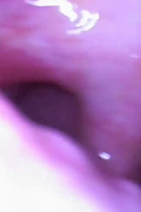 Nurse Gives You Rectal Exam