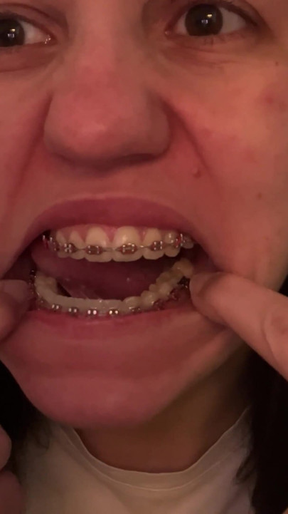 Lambendo seu aparelho com sua língua