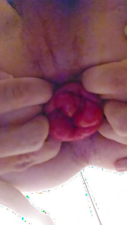 Working hard on my prolapse