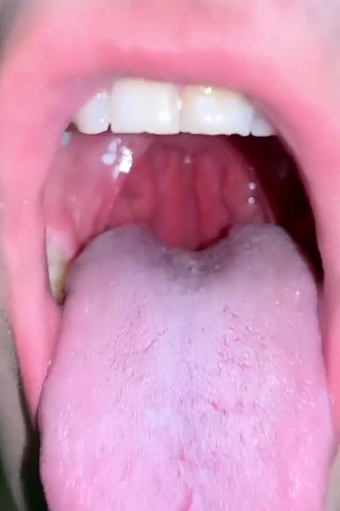 내시경을 가진 POV