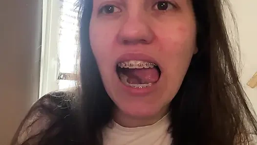 Dilinizle diş teli yalamak