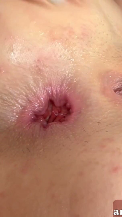 Anal sex opens the asshole of brunette skinny teen | Clip 3