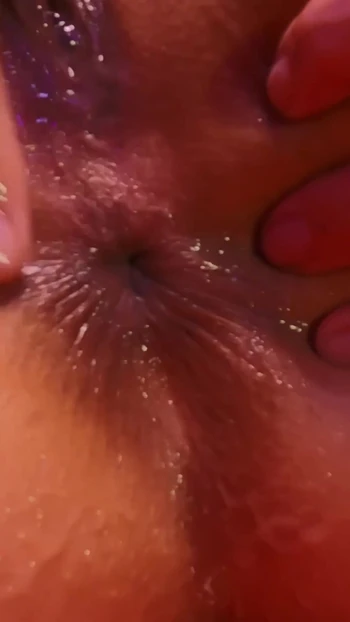 Closeup of my butthole!