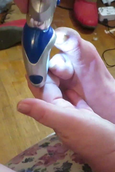 Nurse Vicki grinds her toe nails down with her electric Pedi egg tool ! Poor ugly toes need it real bad!