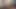 Bold and explosive anal fisting from a young bi couple who exposes all their charms in close-up and in good quality.
