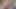 Sensuality Bottle Anal and Anal Prolapse