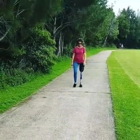Amputace