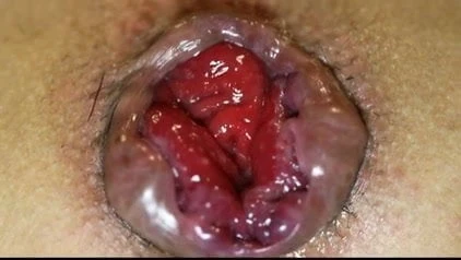 ANAL FINGERING