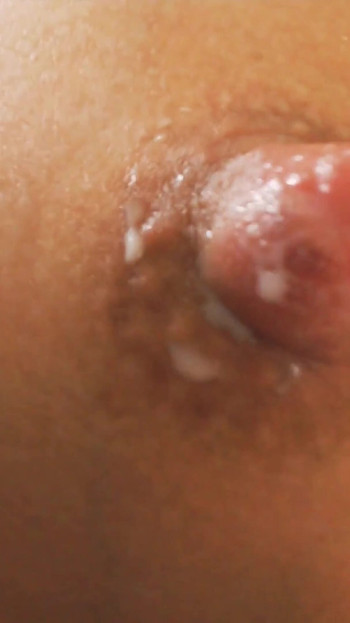 Payudara memerah Susu Hari Sunny