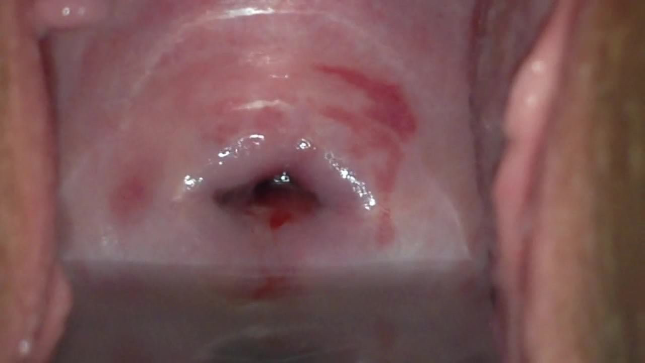 cervix