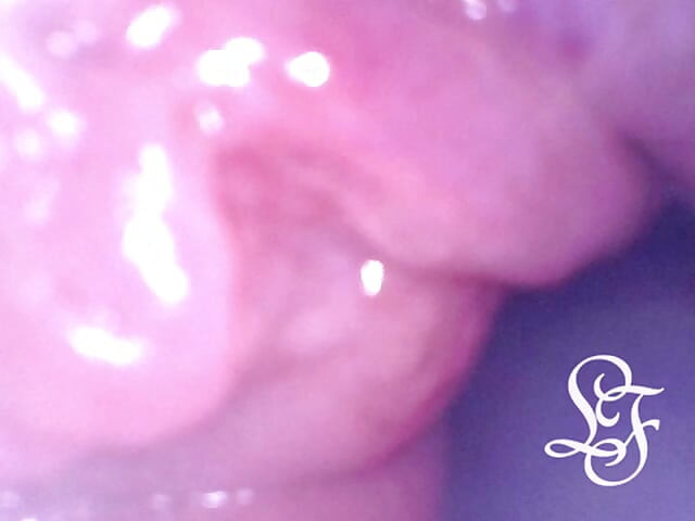 Exploring the Depths of my Ass with the Minicam!