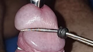 Urethral catheterization and estimation312