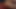 dilation