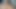 目の痛みのための角質サイト–太ももの間でとてもジューシー
