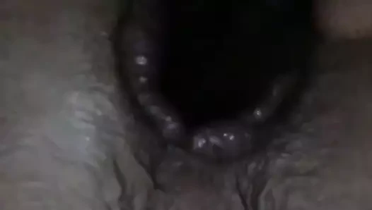 anal esneme