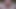 Pink big dildo in Dirtygardengirl ass & anal prolapse extreme