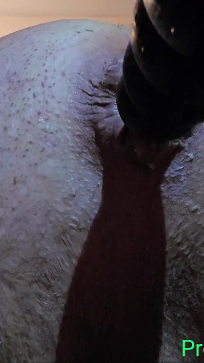 Closeup prolapso anal com plug anal inflável