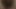 尻頬準備