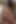 Derin. Seksi hemşire Angela White hasta manuel ile ilgileniyor