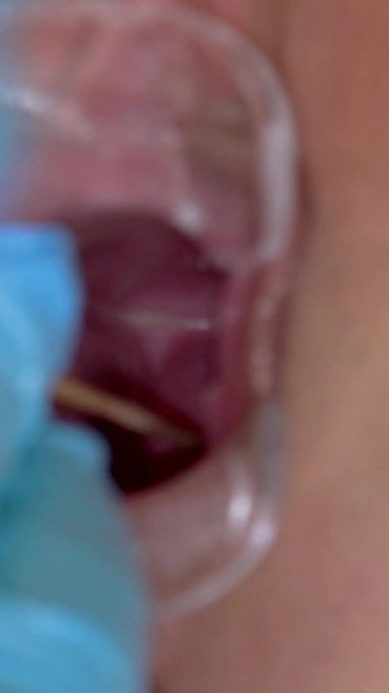 Unforgettable moment from "Kinky gyno exam of horny chubby young miss Aleya Sun"