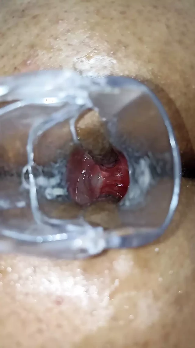 Kendall 9 masturbates her tight anus with a speculum
