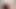 A huge anal prolapse fell out of the anus of a young guy after fucking with a monstrous dildo