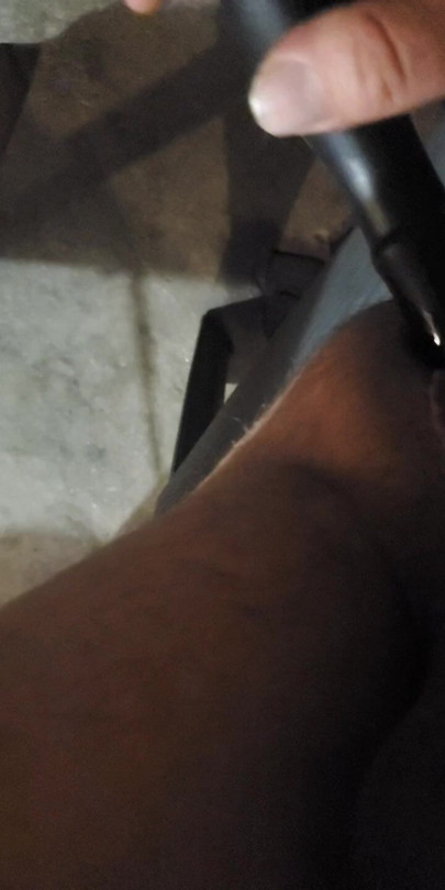 Prostate precum with pee
