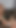 لحظة مذهلة من "ممرضات برازيليات يعتنين بمريض"