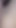 Spectacular moment from "18 Hard First Anal - After He Filled My Tight 18 Pussy With Cum He Distroy My Ass ( Add Me Free Nudes )"