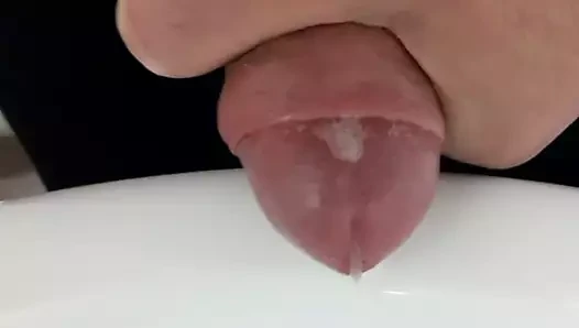 Sperm