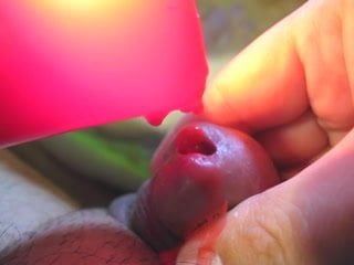 Urethra v horkém červeném vosku