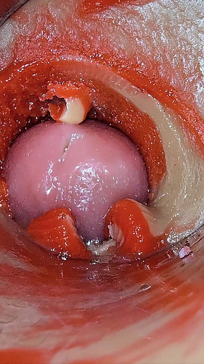 深いマンコの中のカメラが精子の過剰摂取射精をキャプチャ asmr