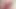 Foreskin movement (slowmotion) 417