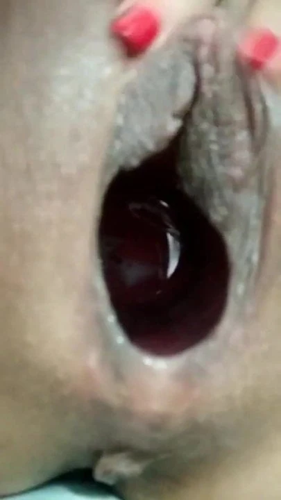 insertions