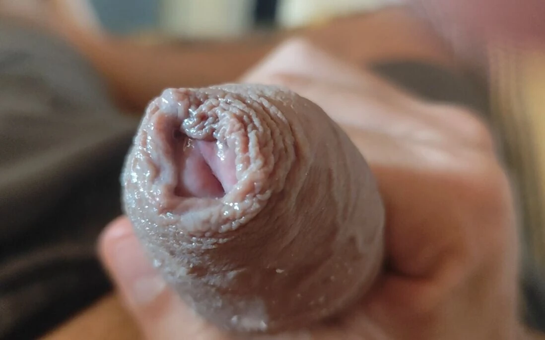 Great Phimosis Getting in the Way of the Boy’s Orgasm