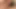 1000 Gesichtsbesamungen
