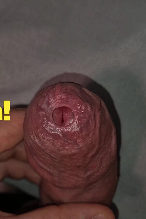Close up on Phimosis Large Cock, so Hot!