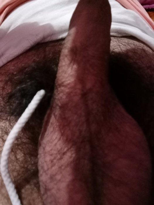 Uncircumcised penis showing glans penis