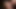 Allie pus yüz cumpilation