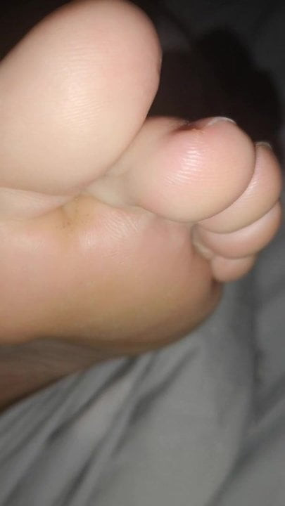 Feet