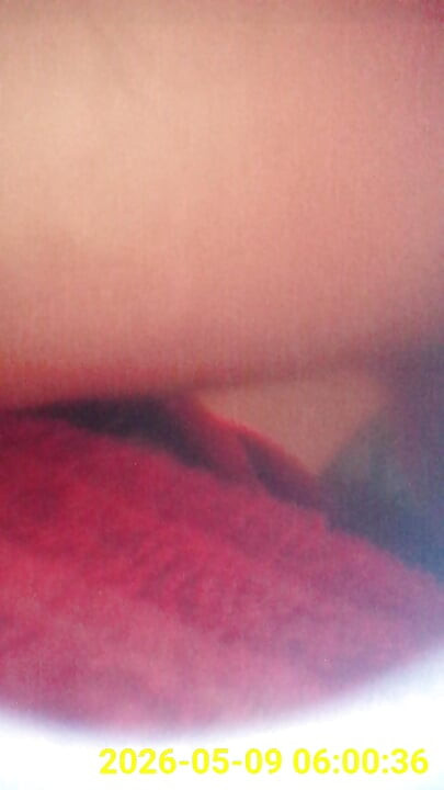 Close up of buttplug & HD Endoscope insertion