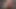 Teaser