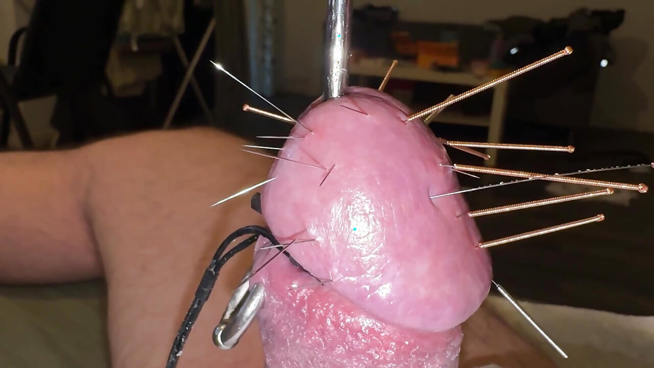 Acupuncture - Orgasm!