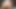 Deep Anal Masturbation Big Gaping Hot Anal Prolapse