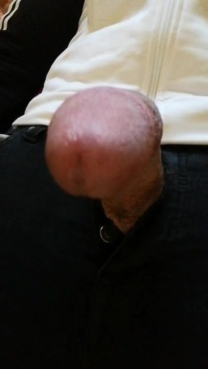 Dick