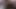 Lizzy Yum VR MAY 2023 JUST my PUSSY #1 post op orgasm pussy anal masturbation teasing orgasm and bathing