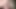 Foreskin movement (slowmotion) 469