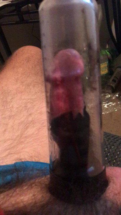 penis pump